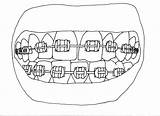 Braces Draw Norman sketch template