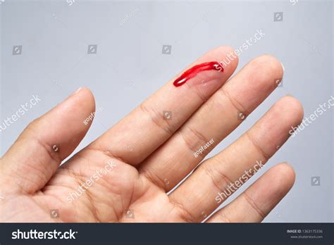7 980件の「bleeding Finger」の画像、写真素材、ベクター画像 Shutterstock
