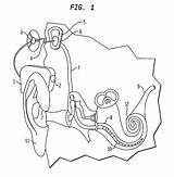Patents Implant Cochlear sketch template