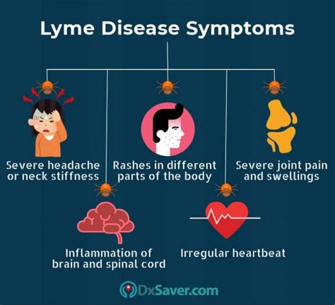 lowest lyme disease test cost   book