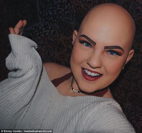 maryland teen with alopecia embraces her bald head daily mail online