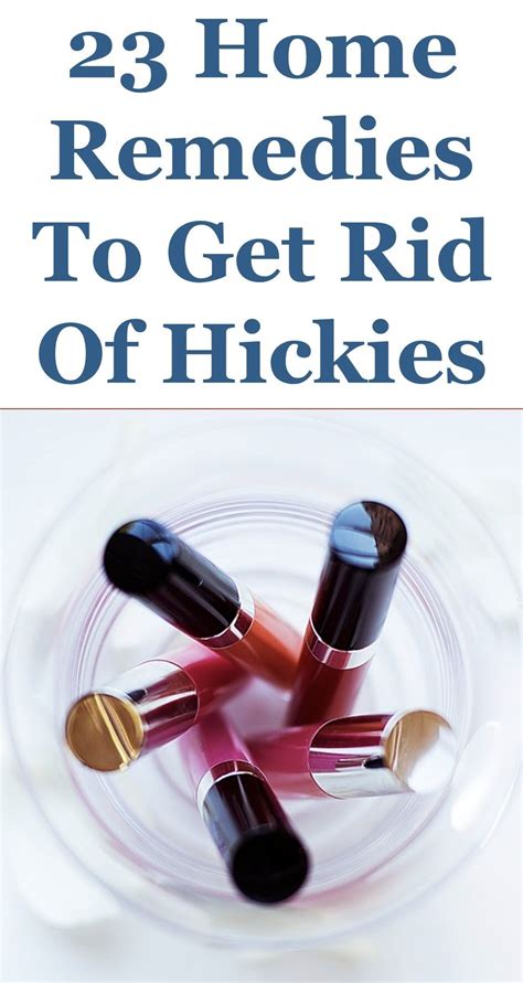 how to remove hickeys howotrmevo
