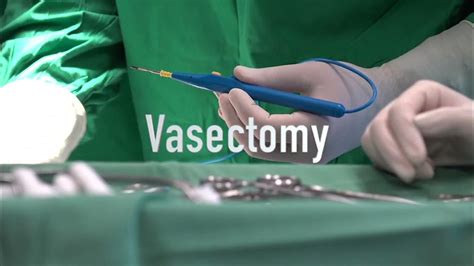 Vasectomy Youtube