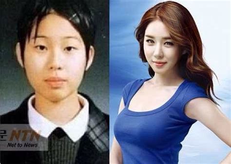 korean actors actresses before and after plastic surgery k drama amino