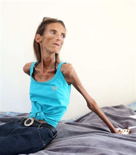 thinnest woman   world  impressive stories legitng