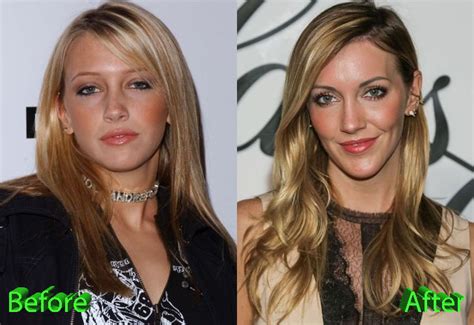 katie cassidy plastic surgery not the best of ideas
