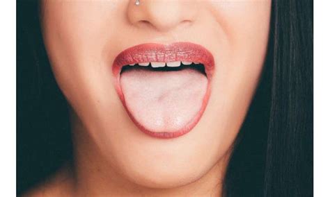 tongue microbiome   identify patients  early stage