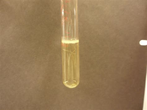 microbediscoveries oxygen requirements lab results  starch lipid  casein test