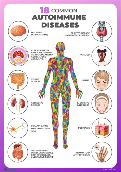 autoimmune diseases  risk factors   list    common autoimmune diseases