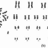 Giemsa Chromosome Chromosomes Stained Microscopic Male Proposed Varifocal Varied Given sketch template