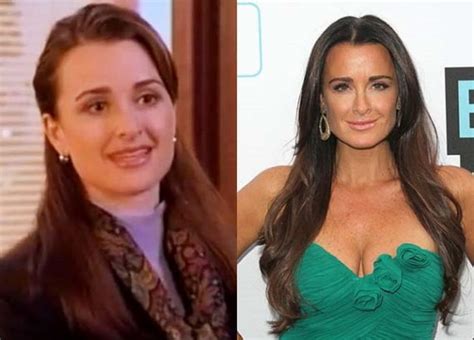 Kyle Richards Plastic Surgery With Before And After Photos