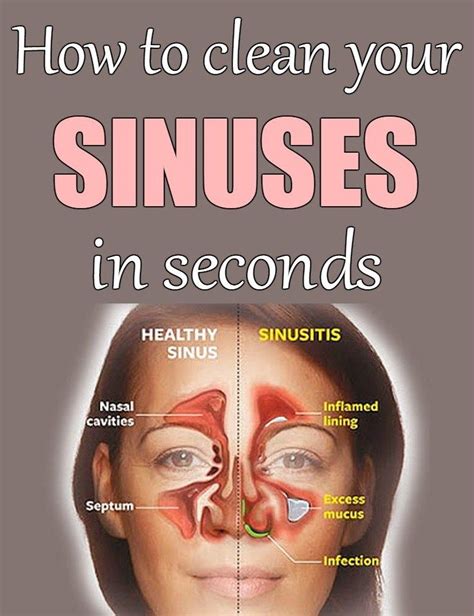 quick   clear  sinuses anna blog