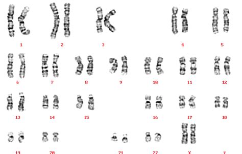 A Karyotype Of A Normal Female 46 Xx Reproduced Courtesy Of Human