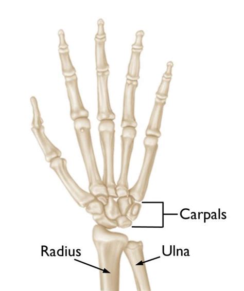 arthritis   wrist orthoinfo aaos