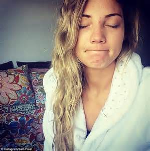 Sam Frost Posts A Stunning Selfie Hours After Suffering A Pimply Break