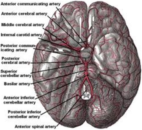 basilar artery migraines bam