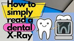 How To Understand Your Dental X-rays | How to Read Dental X-Rays |Radiographic Interpretation