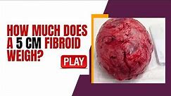 How Much does a 5 CM Fibroid Weigh? [SEE HERE]
