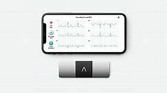 Portable Single-Lead Heart Monitor | KardiaMobile