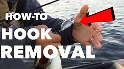How To Fishing Hook Removal - ANGLER BURIES HOOK IN HAND