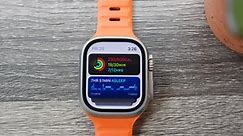 Can my Apple Watch get watchOS 10? Here’s every supported model