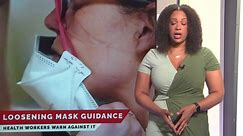 CDC loosening mask guidance for health professionals