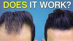 Does Hair Fiber SPRAY Work? BETTER Hair Coverage?