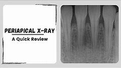 Periapical x ray | Intraoral Dental Radiograph