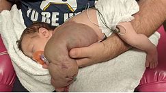 Tot born with 1kg cyst under her arm - so heavy it's making her spine curve