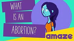 What Is An Abortion?