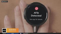 New stethoscope uses AI to help doctors find heart valve problems