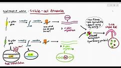 6-10 Effects of Gene Mutation, Sickle Cell Anaemia (Cambridge AS & A Level Biology, 9700)