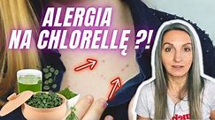 Chlorella - nietolerancja, alergia, reakcja oczyszczająca? Skutki uboczne stosowania chlorelli.
