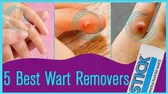 Top 5 Best Wart Removers of 2022 Reviews In 2022