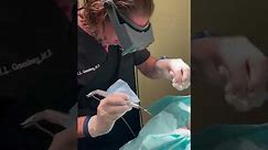 Cyst Excision on the Sternum at Las Vegas Dermatology