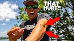 EASIEST HOOK REMOVAL TRICK...I HOOKED MYSELF TO PROVE IT! ( How to remove a fish hook )
