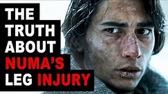Numa Turcatti's Leg Injury Didn't Happen That Way | The Real Story | Society of the Snow