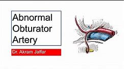 Abnormal (Aberrant) Obturator Artery (Corona Mortis) • Video • MEDtube.net