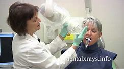 How to take dental x-rays with bisecting angle positioning