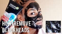 garnier charcoal peel off mask | removing blackheads