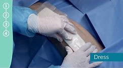 Application of the PICO System after knee surgery