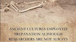 Drilling Holes in the Human Skull | Trepanation | Trepanning #shorts #history #historyfacts