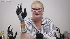 How this breakthrough bionic hand uses AI