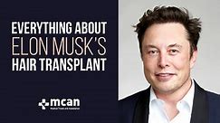 Everything About Elon Musk Hair Transplant