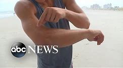 Surfer's shark bite caught on camera off Florida coast