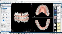 Webinar Orthodontics. The best solution for your Ortho treatments 2022-06-02.mp4