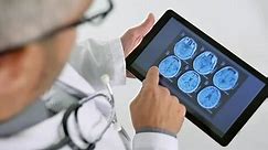 Doctor Looking Brain X Rays Scan Stock Footage Video (100% Royalty-free) 24273206 | Shutterstock