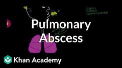 Pulmonary abscess | Respiratory system diseases | NCLEX-RN | Khan Academy