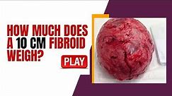How Much does a 10 CM Fibroid Weigh? [LEARN MORE]