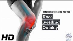 Knee Swelling Begone! 8 Effective Home Remedies You Can Try Today